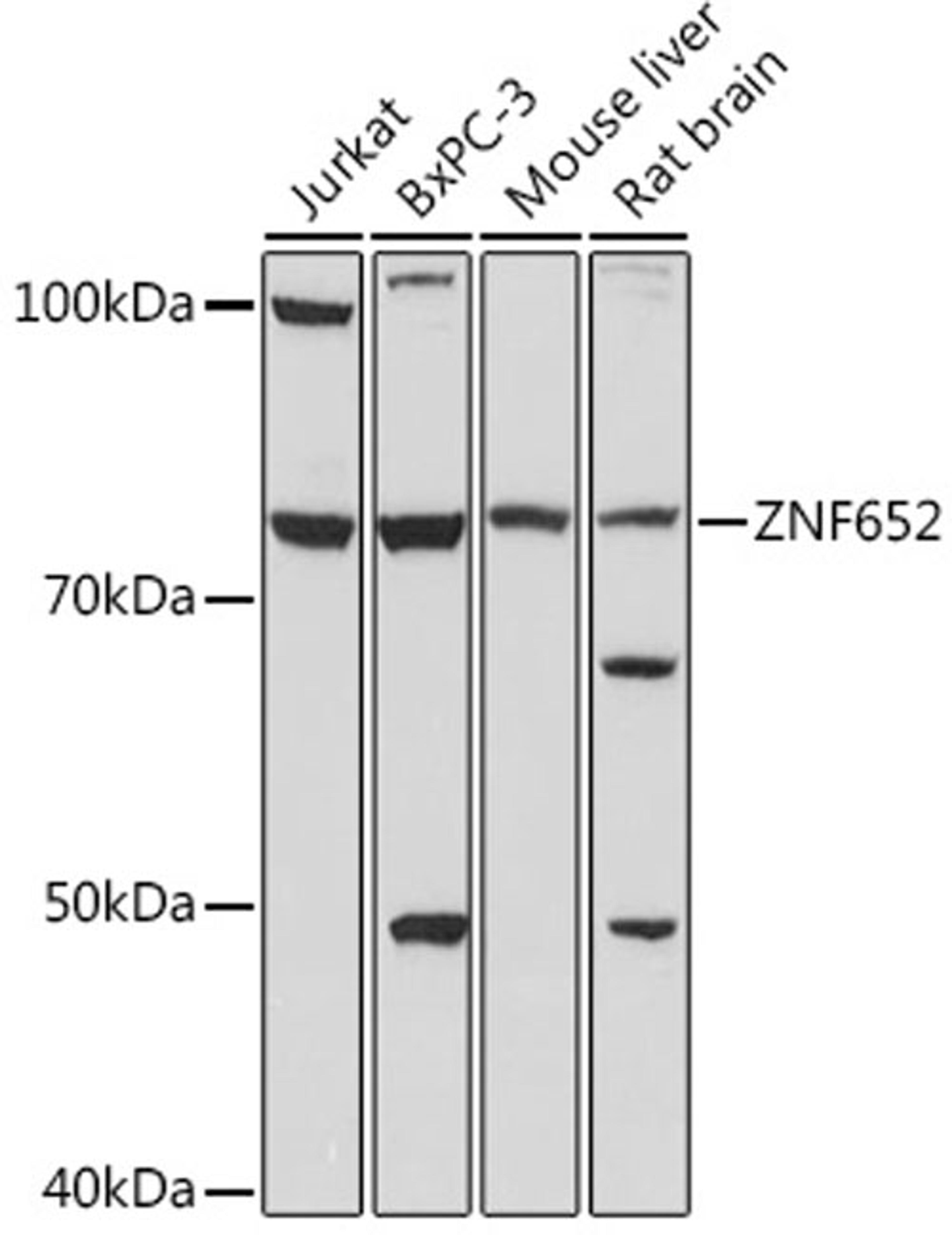 Western blot - ZNF652 antibody (A18657)