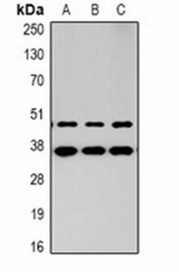 Western blot analysis of  human brain (Lane1), mouse brain (Lane2), rat brain (Lane3) whole cell lysates using MAS antibody