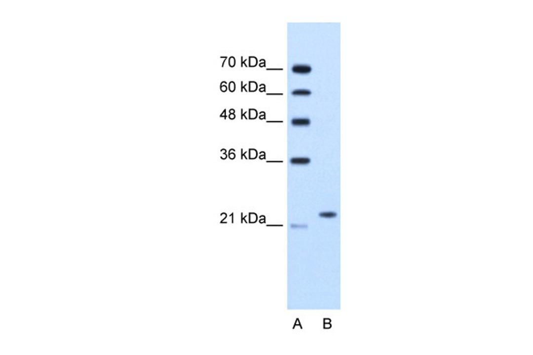 Antibody used in WB on Human Jurkat 1.25 ug/ml.