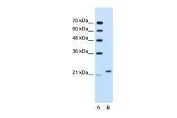 Antibody used in WB on Human Jurkat 1.25 ug/ml.