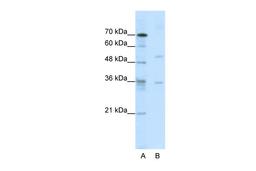 Antibody used in WB on Human Jurkat cells at 0.2-1 ug/ml.