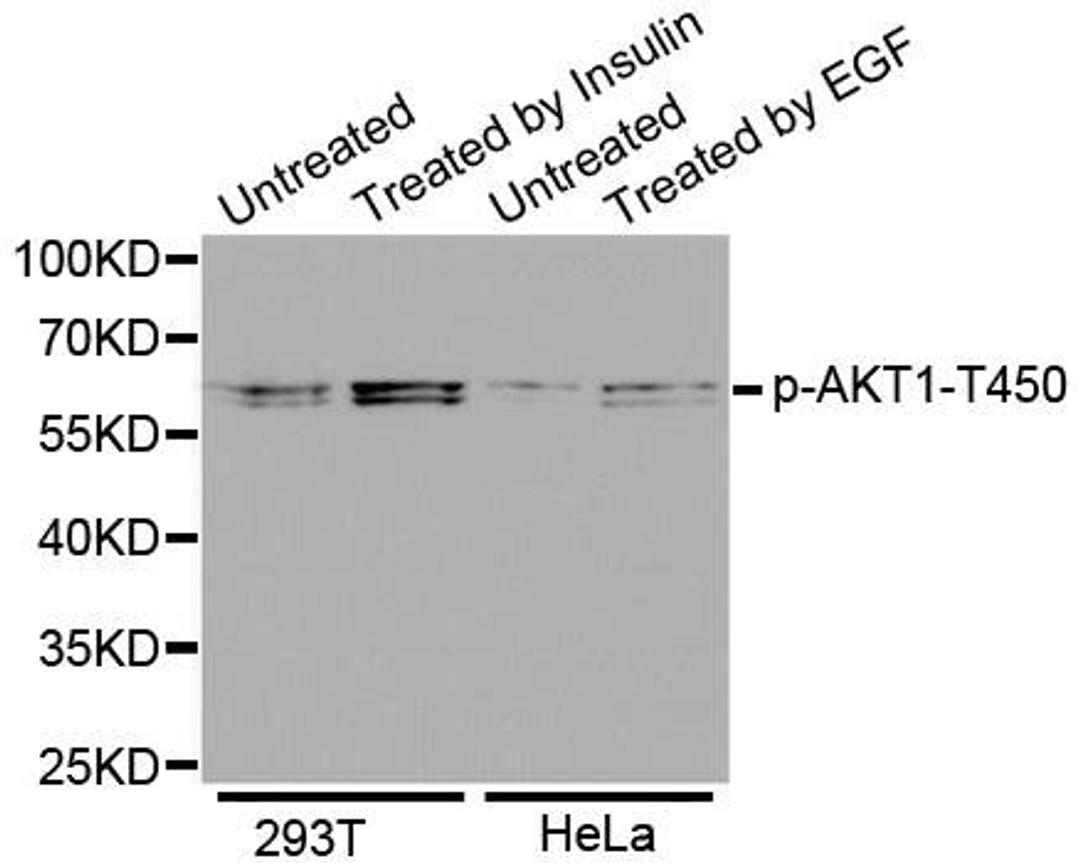 Western blot analysis of extracts of various cell lines using AKT1 (phospho-Thr450) antibody