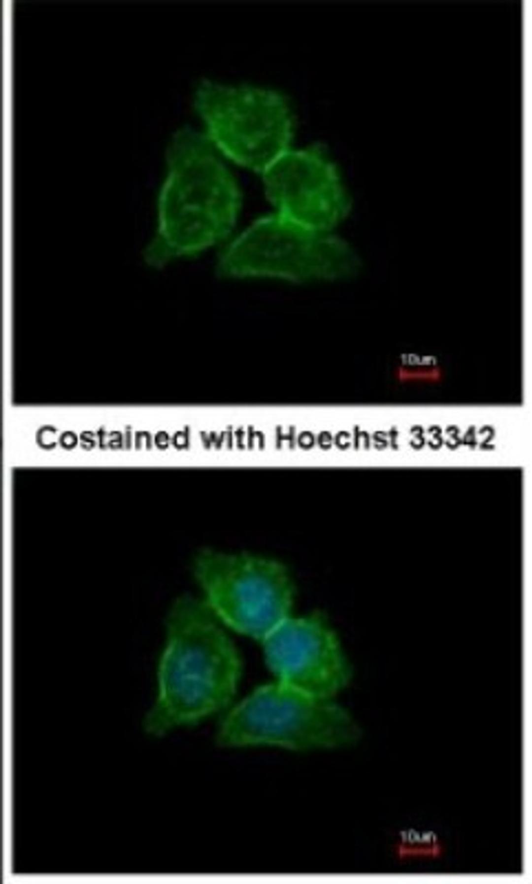 Immunocytochemistry/Immunofluorescence: Annexin A13 Antibody [NBP1-30985] - Analysis of methanol-fixed A431, using Annexin A13 antibody at 1:500 dilution.