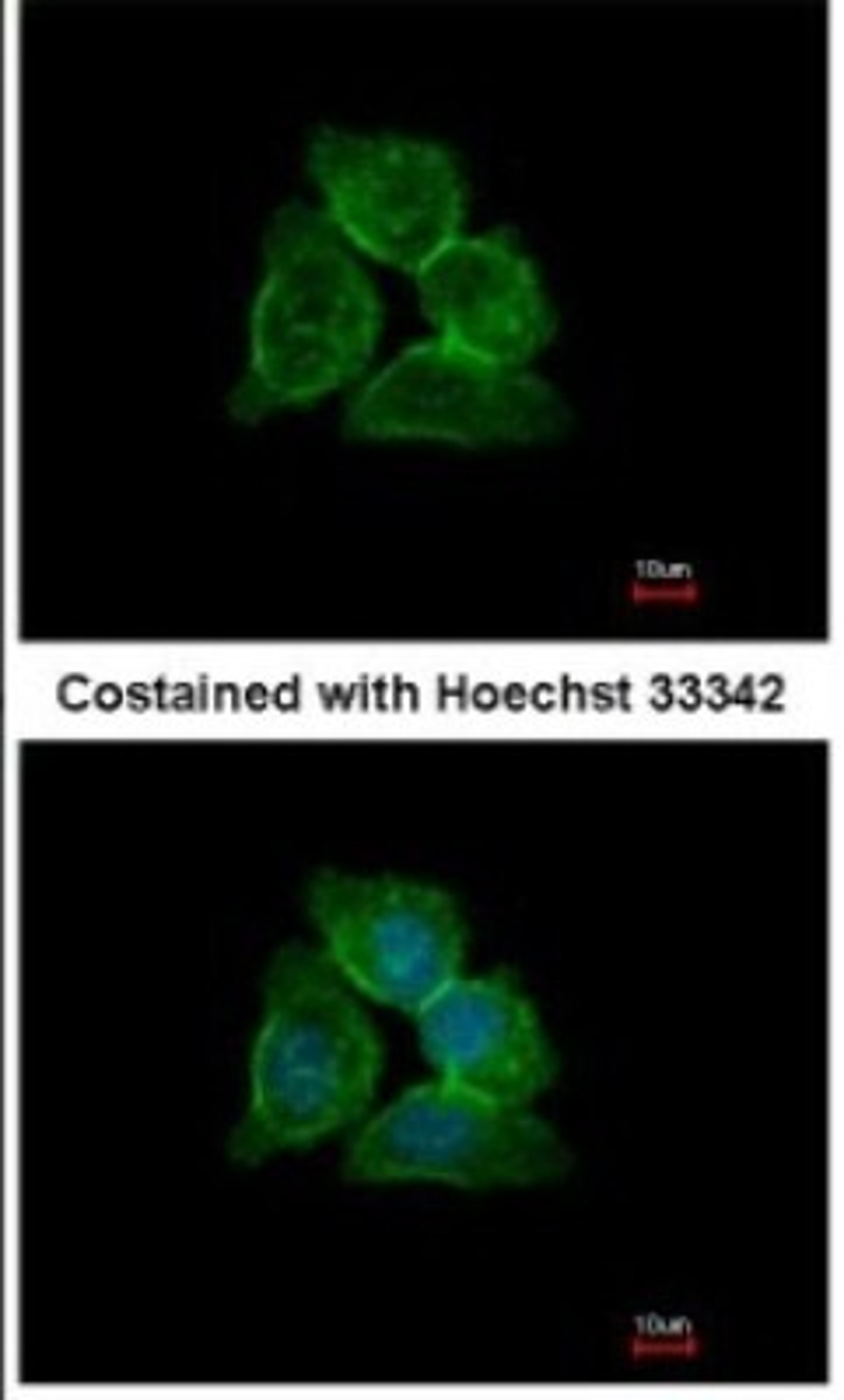 Immunocytochemistry/Immunofluorescence: Annexin A13 Antibody [NBP1-30985] - Analysis of methanol-fixed A431, using Annexin A13 antibody at 1:500 dilution.