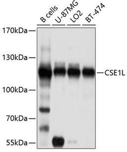 Western blot - CSE1L antibody (A9510)