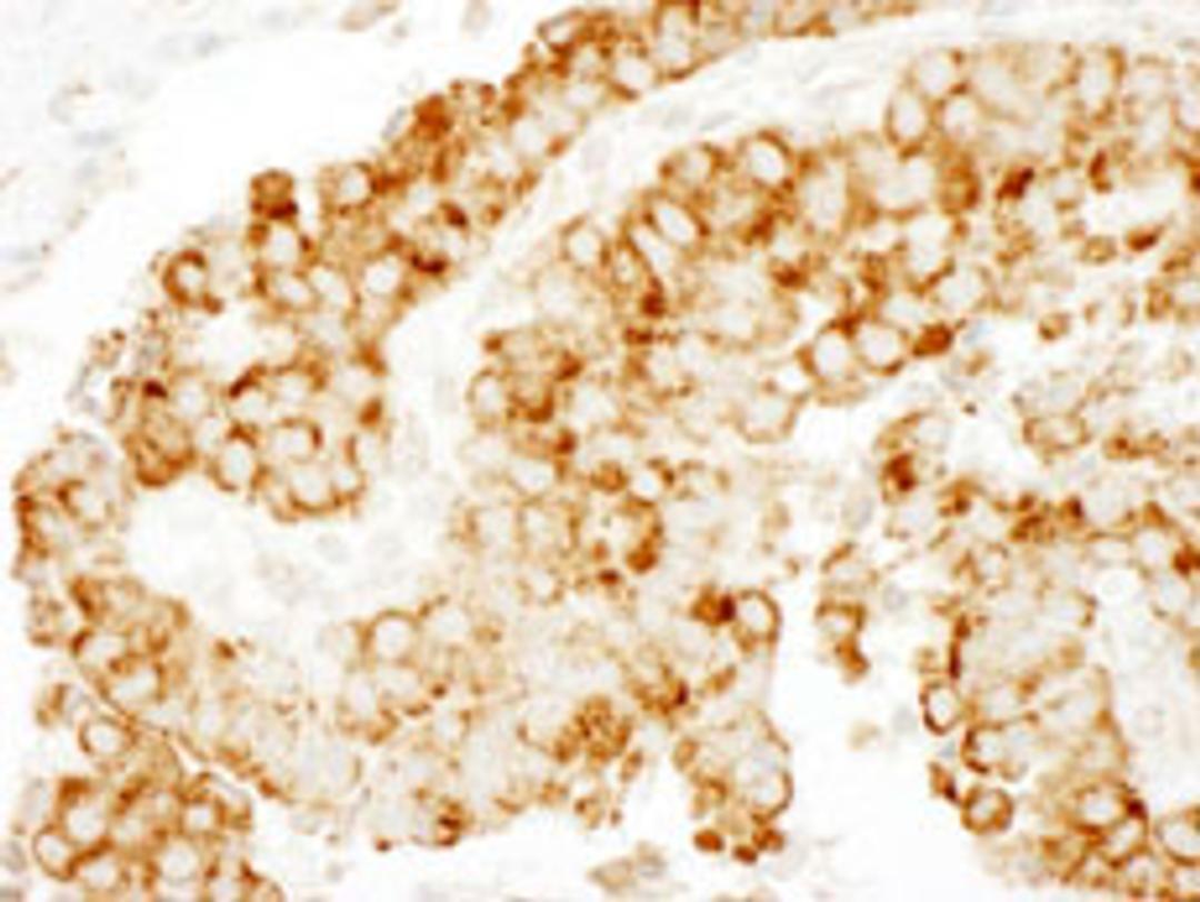 Detection of human CKAP4 by immunohistochemistry.