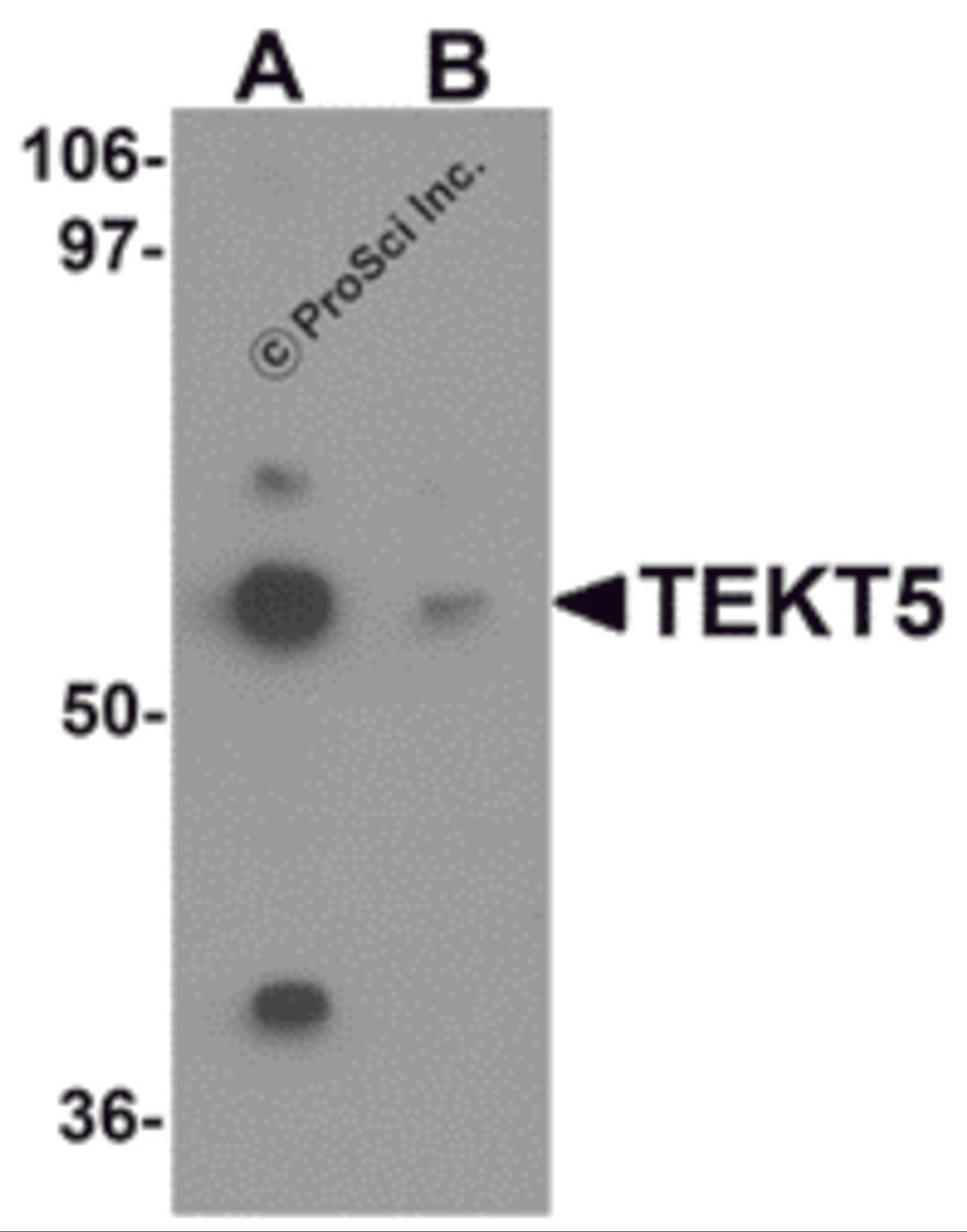 Western blot analysis of TEKT5 in 3T3 cell lysate with TEKT5 antibody at (A) 0.25 and (B) 0.5 μg/mL.