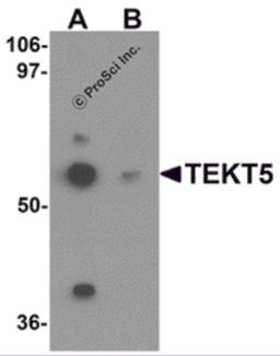 Western blot analysis of TEKT5 in 3T3 cell lysate with TEKT5 antibody at (A) 0.25 and (B) 0.5 μg/mL.