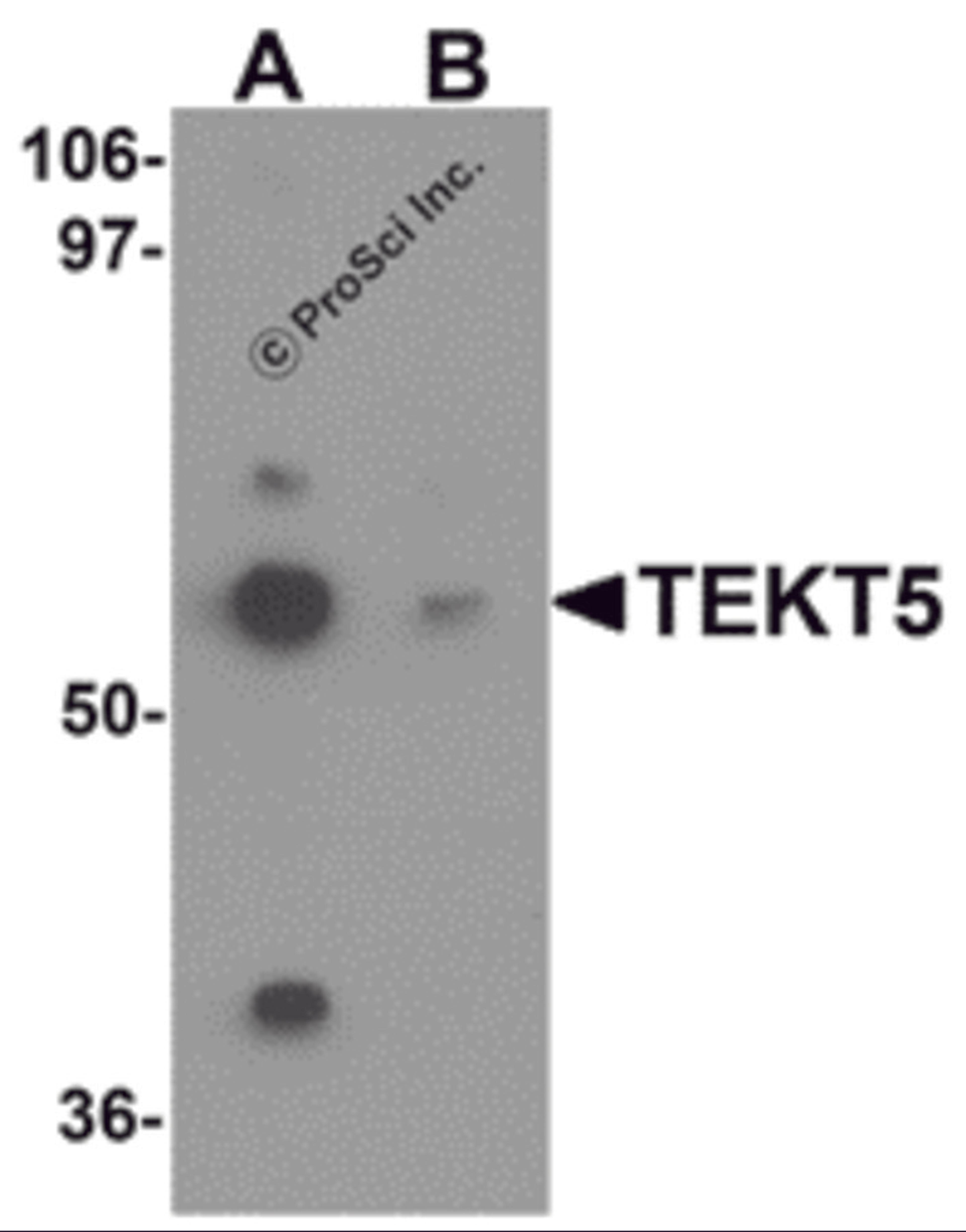 Western blot analysis of TEKT5 in 3T3 cell lysate with TEKT5 antibody at (A) 0.25 and (B) 0.5 μg/mL.