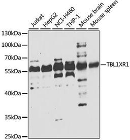 Western blot - TBL1XR1 antibody (A7834)