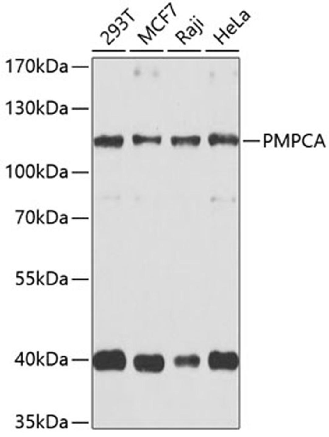 Western blot - PMPCA antibody (A9965)