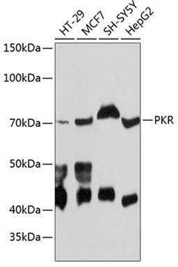 Western blot - PKR antibody (A19545)