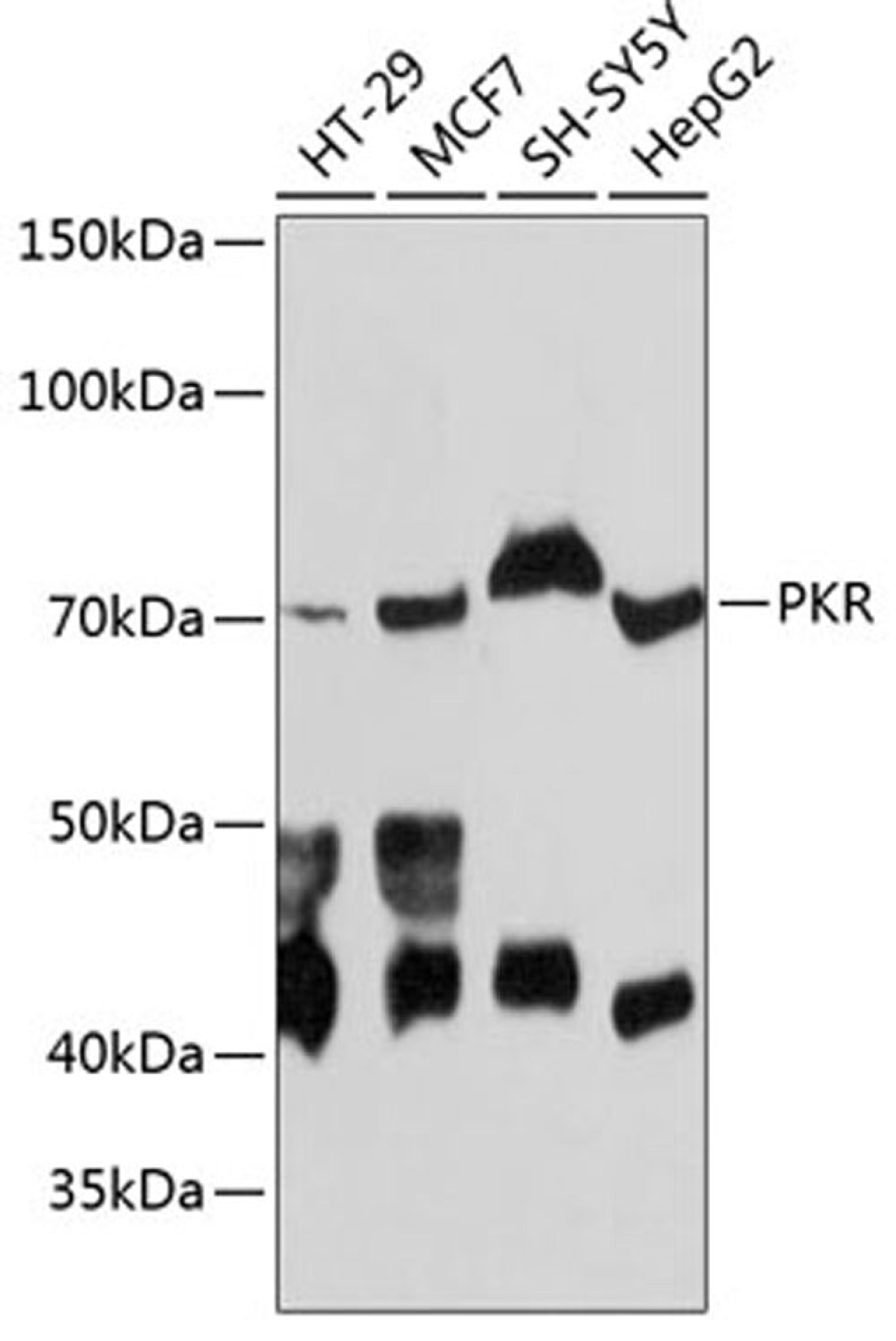 Western blot - PKR antibody (A19545)