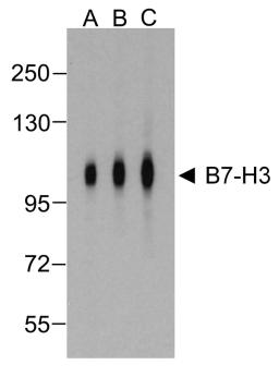 Western blot analysis of B7-H3 in HEK293 cells using B7-H3 antibody at (A) 0.25 (B) 0.5 and (C) 1 &#956;g/ml. 