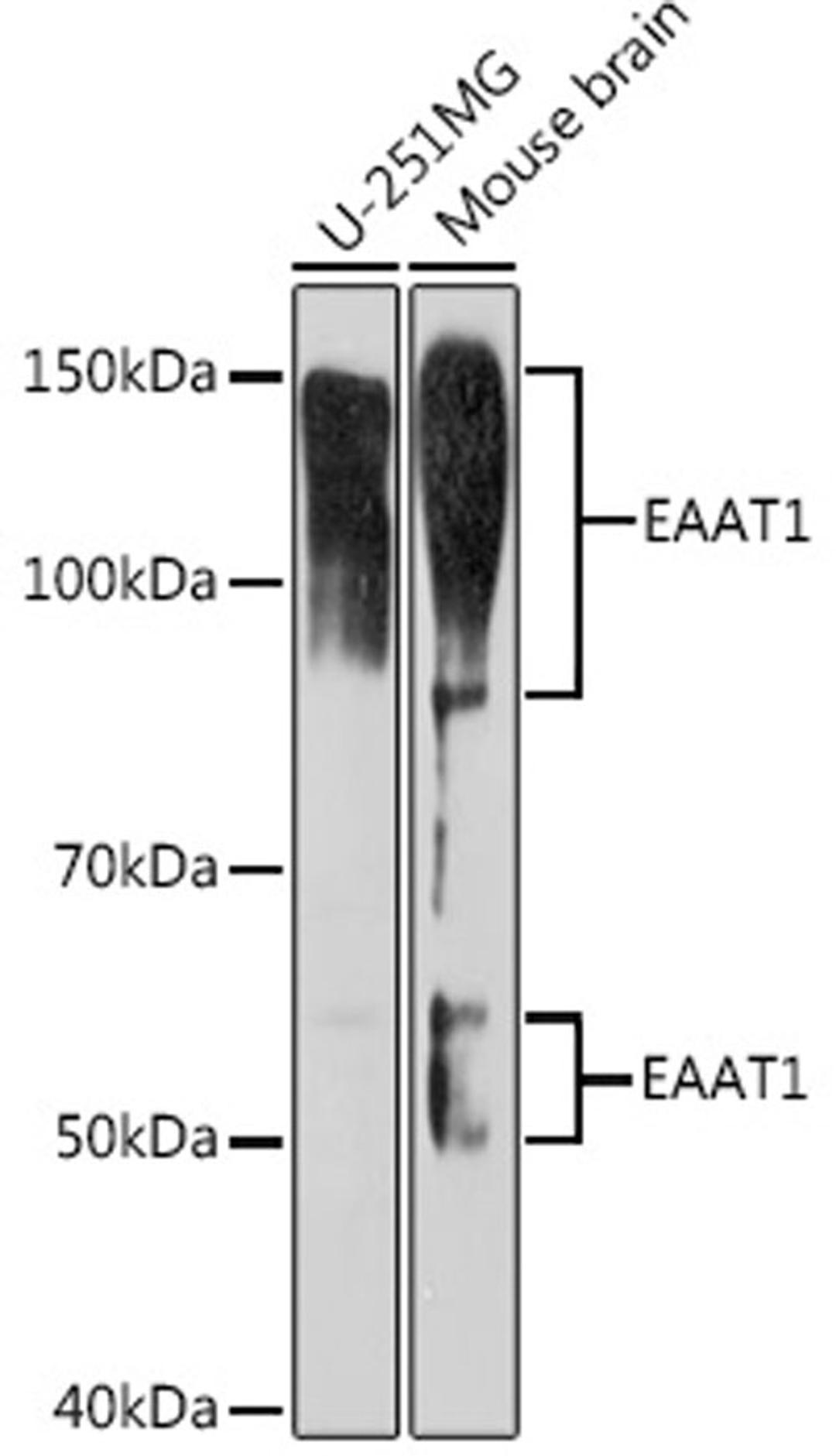 Western blot - EAAT1 Rabbit mAb (A9712)