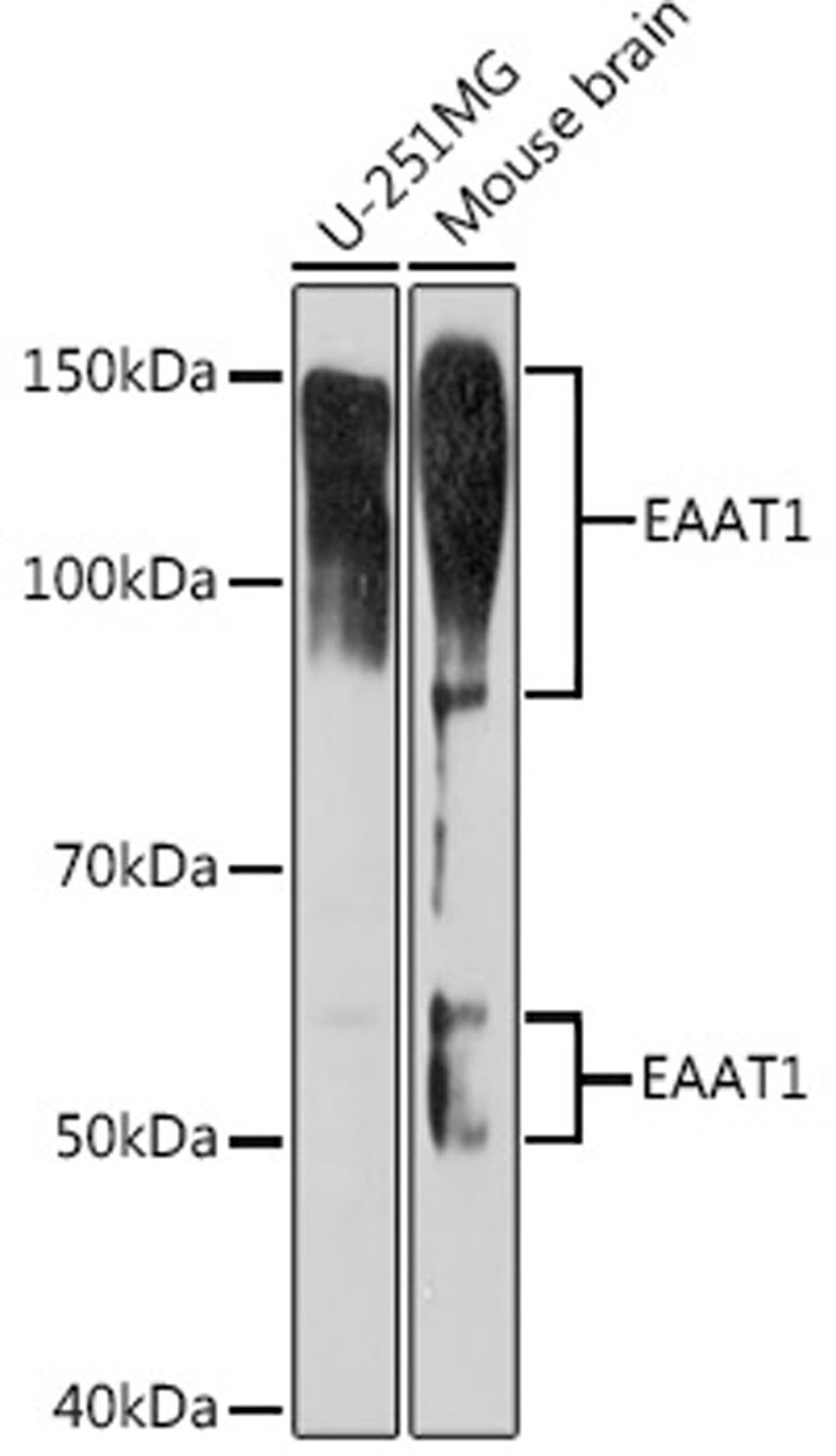 Western blot - EAAT1 Rabbit mAb (A9712)