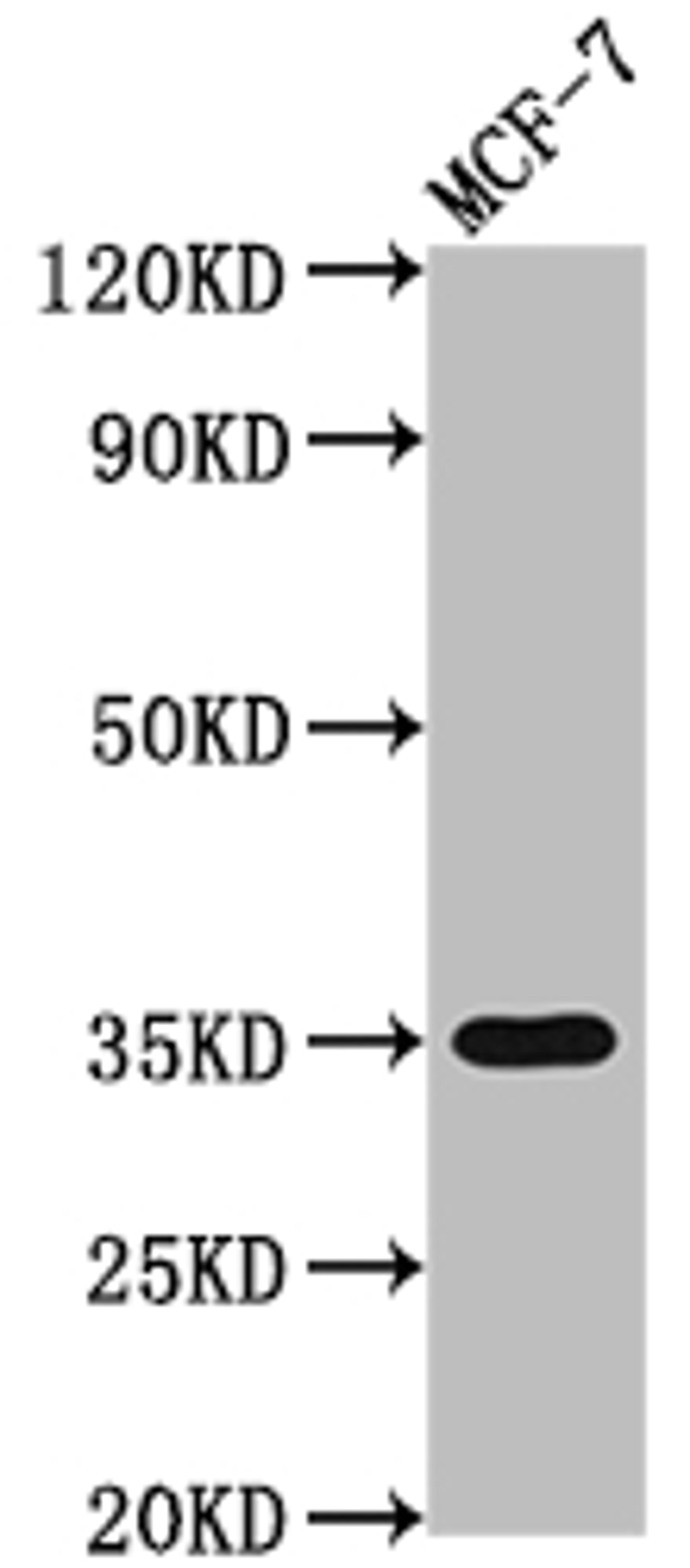 Western Blot. Positive WB detected in: MCF-7 whole cell lysate. All lanes: EPCAM antibody at 1:2000. Secondary. Goat polyclonal to rabbit IgG at 1/50000 dilution. Predicted band size: 35 kDa. Observed band size: 35 kDa. 