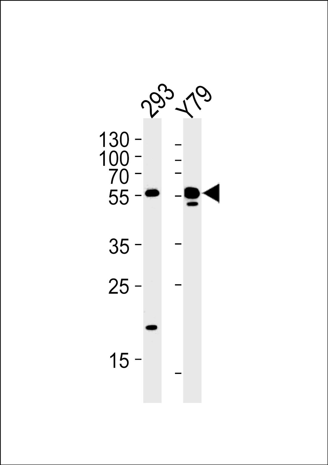 Western blot analysis in 293,Y79 cell line lysates (35ug/lane).