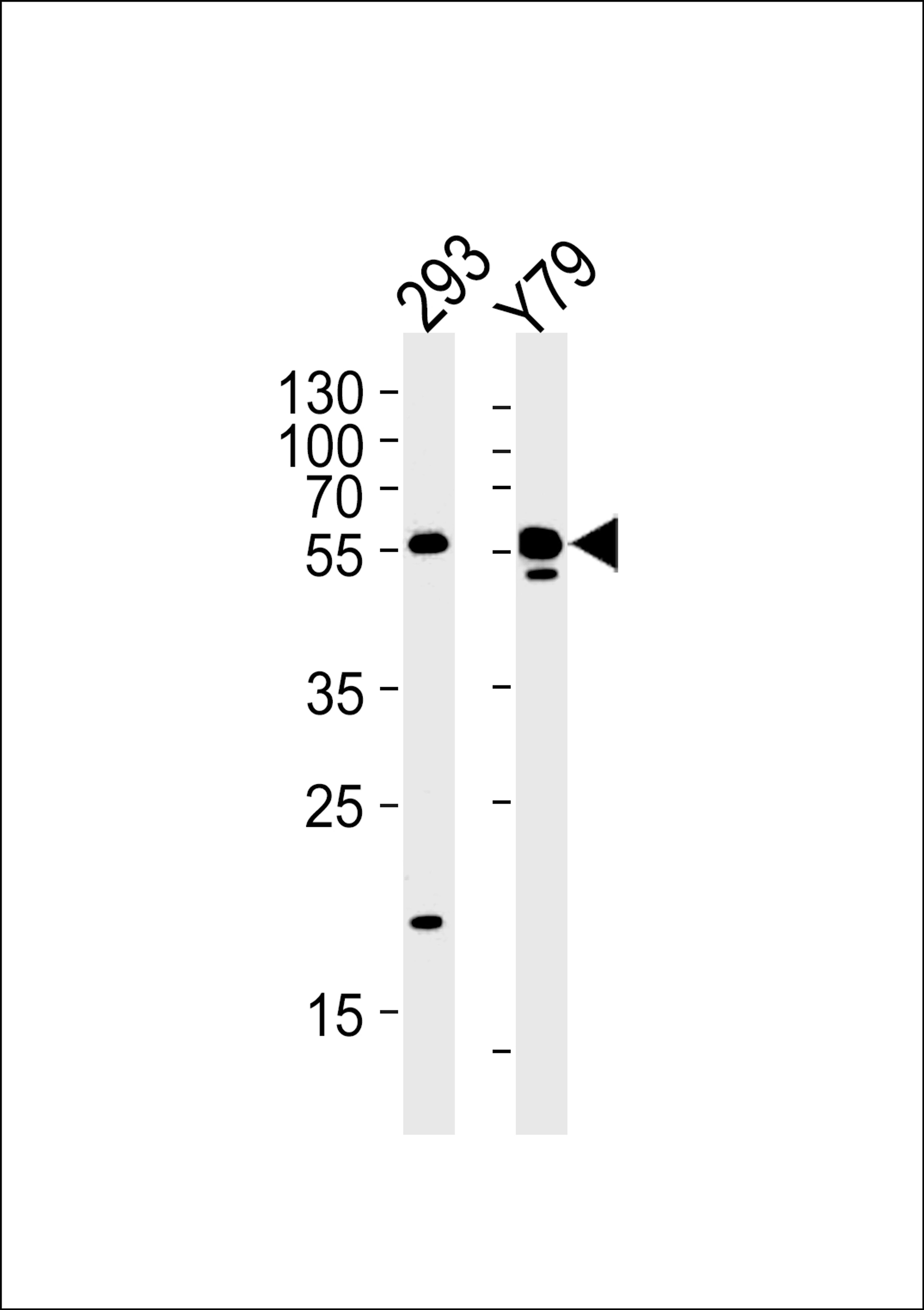 Western blot analysis in 293,Y79 cell line lysates (35ug/lane).