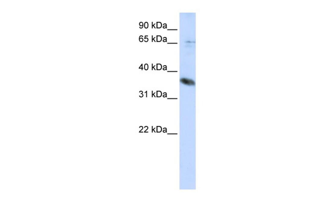 Antibody used in WB on Human HepG2 at 0.2-1 ug/ml.