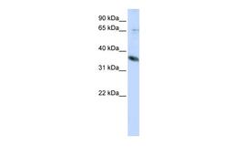 Antibody used in WB on Human HepG2 at 0.2-1 ug/ml.