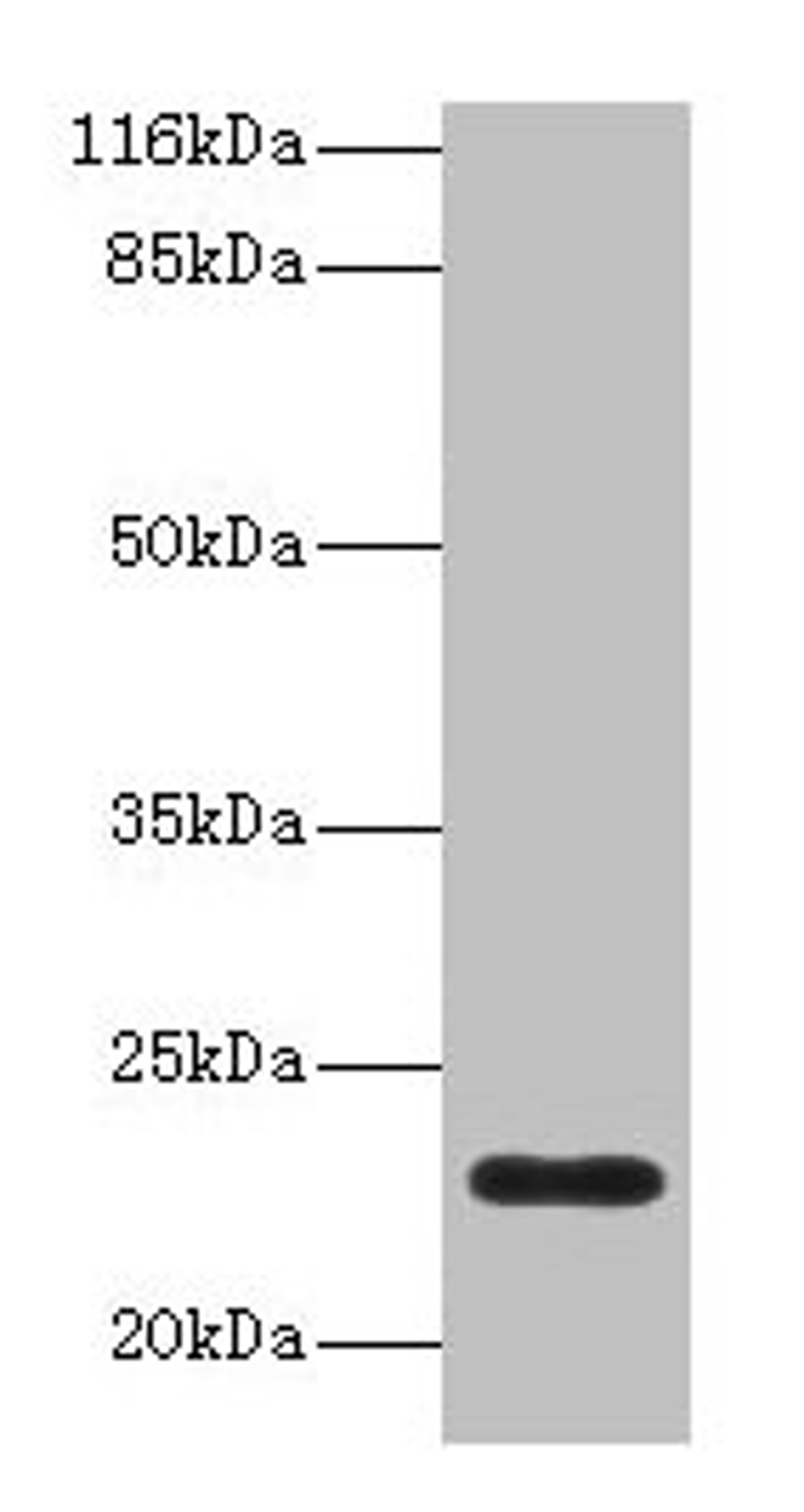 Western blot. All lanes: C8G antibody at 2µg/ml + Human serum. Secondary. Goat polyclonal to rabbit IgG at 1/10000 dilution. Predicted band size: 23 kDa. Observed band size: 23 kDa