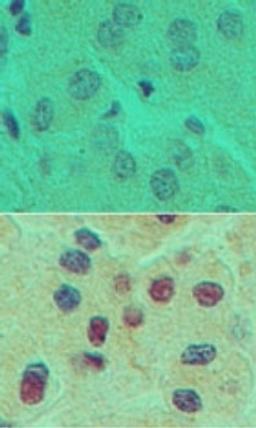 Immunohistochemistry-Paraffin: HNF6 Antibody [NBP2-27079] - Analysis of HNF6 in formalin-fixed, paraffin-embedded human liver tissue using an isotype control (top) and this antibody (bottom) at 5 ug/ml.