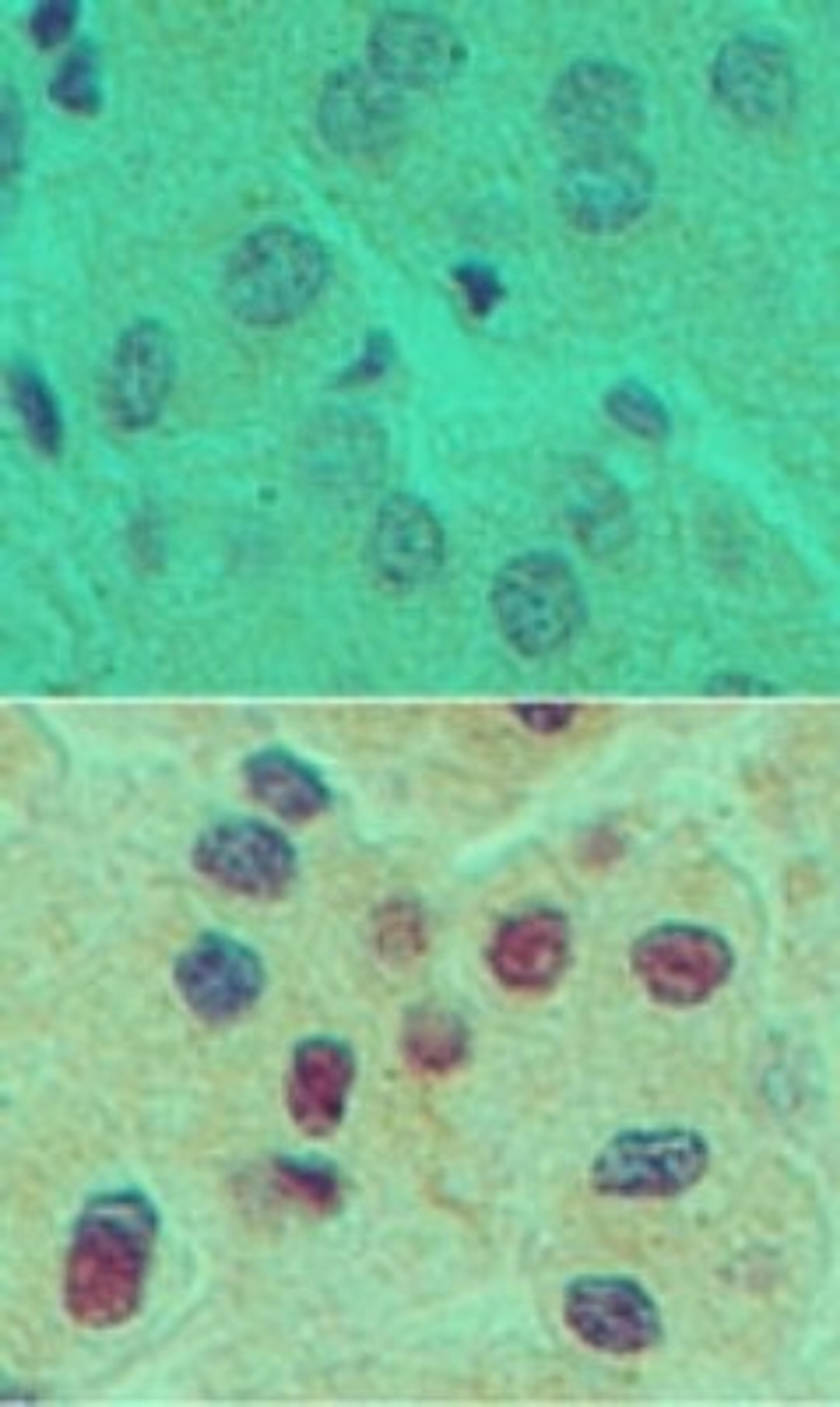 Immunohistochemistry-Paraffin: HNF6 Antibody [NBP2-27079] - Analysis of HNF6 in formalin-fixed, paraffin-embedded human liver tissue using an isotype control (top) and this antibody (bottom) at 5 ug/ml.