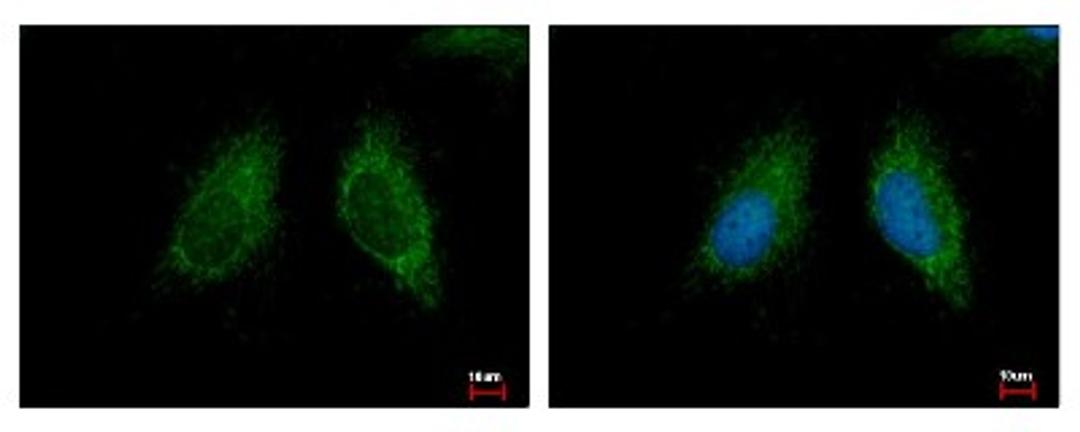 Immunocytochemistry/Immunofluorescence: MCCC2 Antibody [NBP2-17237] - Sample: HeLa cells were fixed in 2% paraformaldehyde/culture medium at 37C for 30 min. Green: MCCC2 protein stained by MCCC2 antibody diluted at 1:500. Blue: Hoechst 33343 staining.