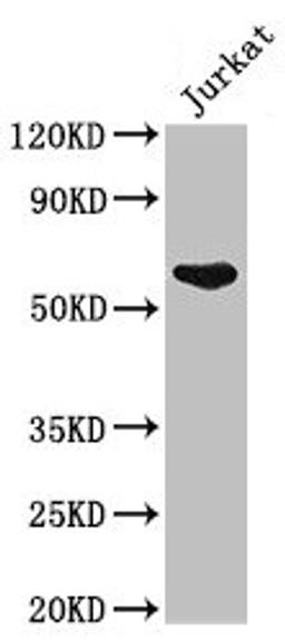 Western Blot. Positive WB detected in: Jurkat whole cell lysate. All lanes: UAP1 antibody at 2.5µg/ml. Secondary. Goat polyclonal to rabbit IgG at 1/50000 dilution. Predicted band size: 59, 58 kDa. Observed band size: 59 kDa