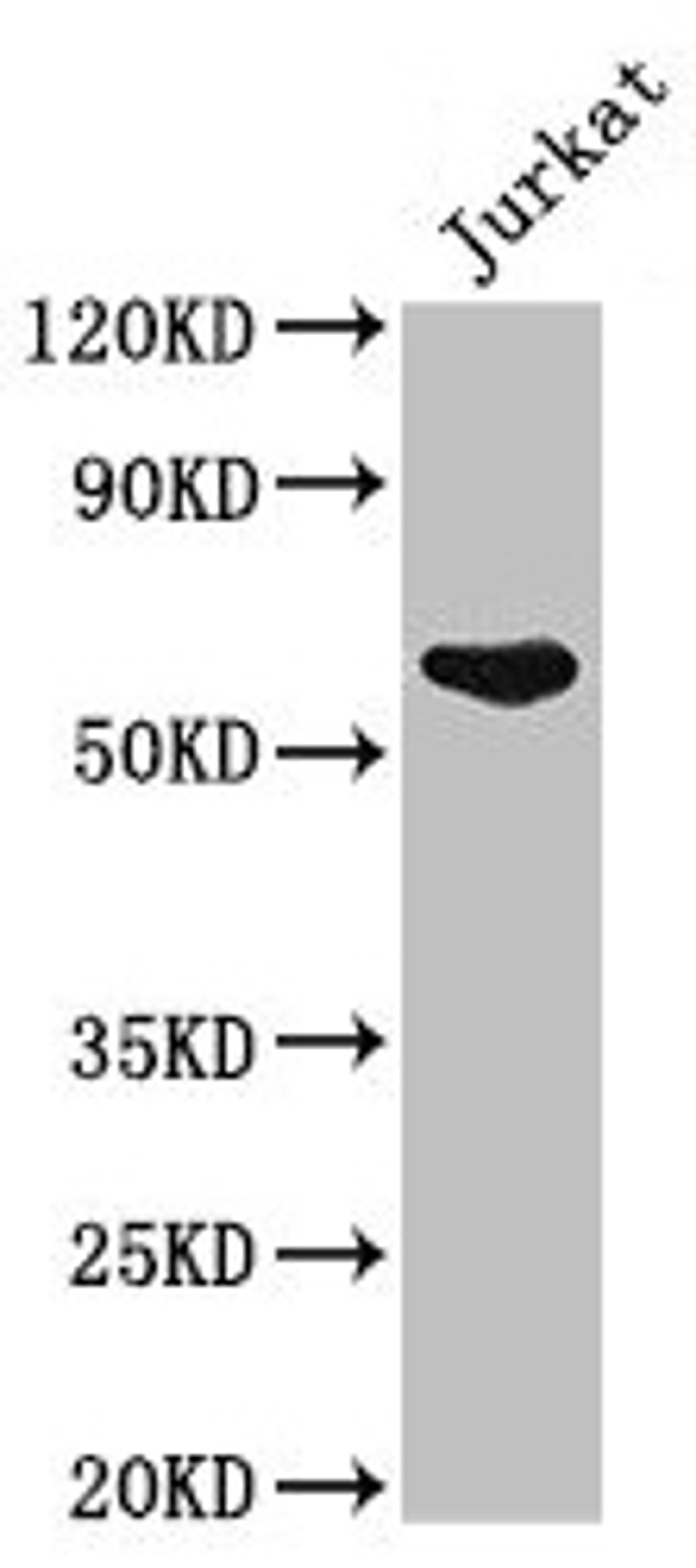 Western Blot. Positive WB detected in: Jurkat whole cell lysate. All lanes: UAP1 antibody at 2.5µg/ml. Secondary. Goat polyclonal to rabbit IgG at 1/50000 dilution. Predicted band size: 59, 58 kDa. Observed band size: 59 kDa