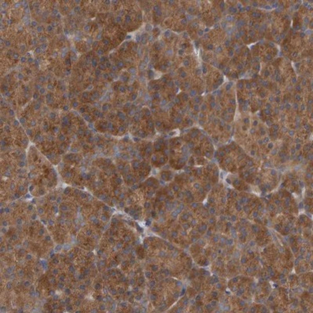 Immunohistochemistry-Paraffin: UBAP1 Antibody [NBP1-80651] - Staining of human pancreas shows strong cytoplasmic positivity in exocrine cells.