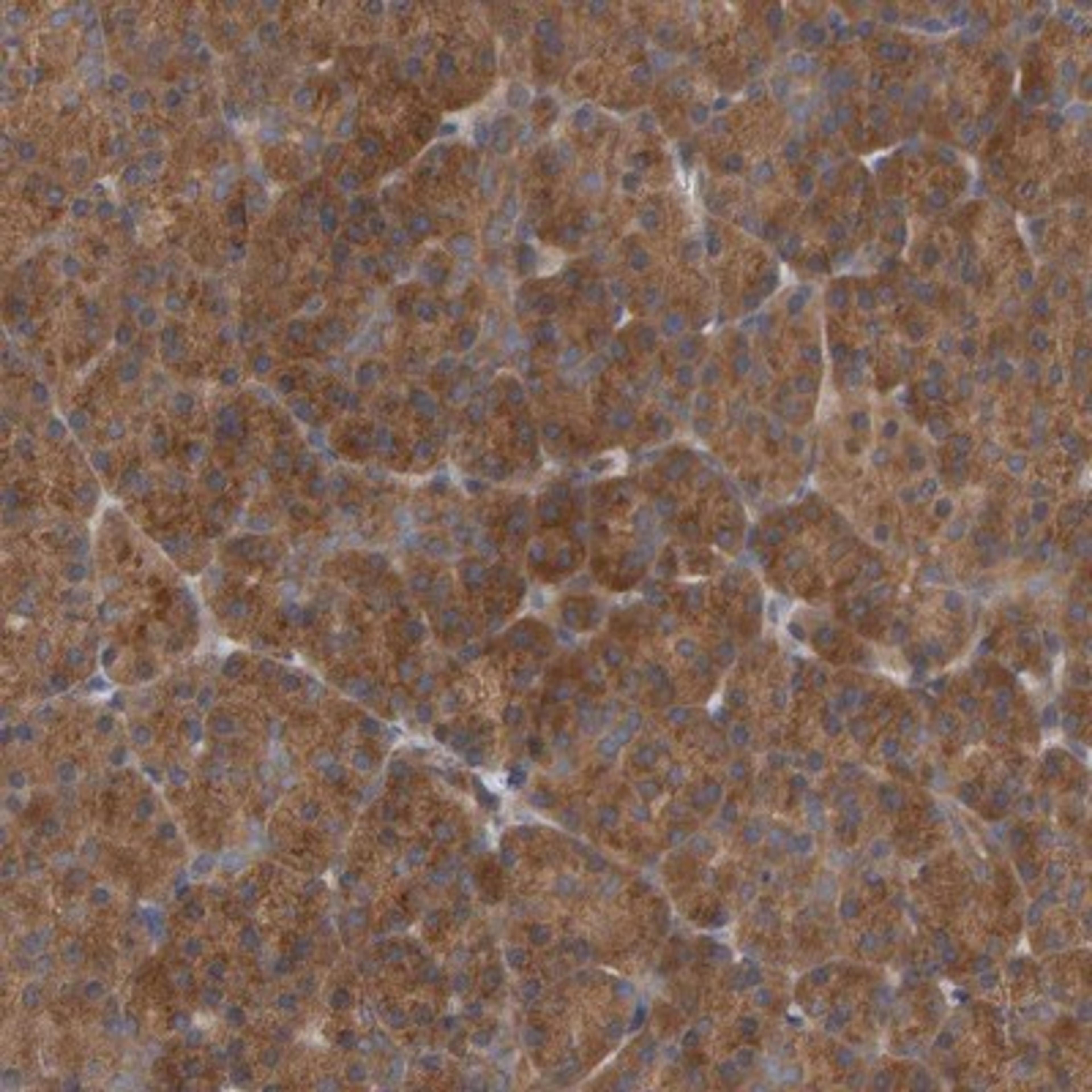 Immunohistochemistry-Paraffin: UBAP1 Antibody [NBP1-80651] - Staining of human pancreas shows strong cytoplasmic positivity in exocrine cells.