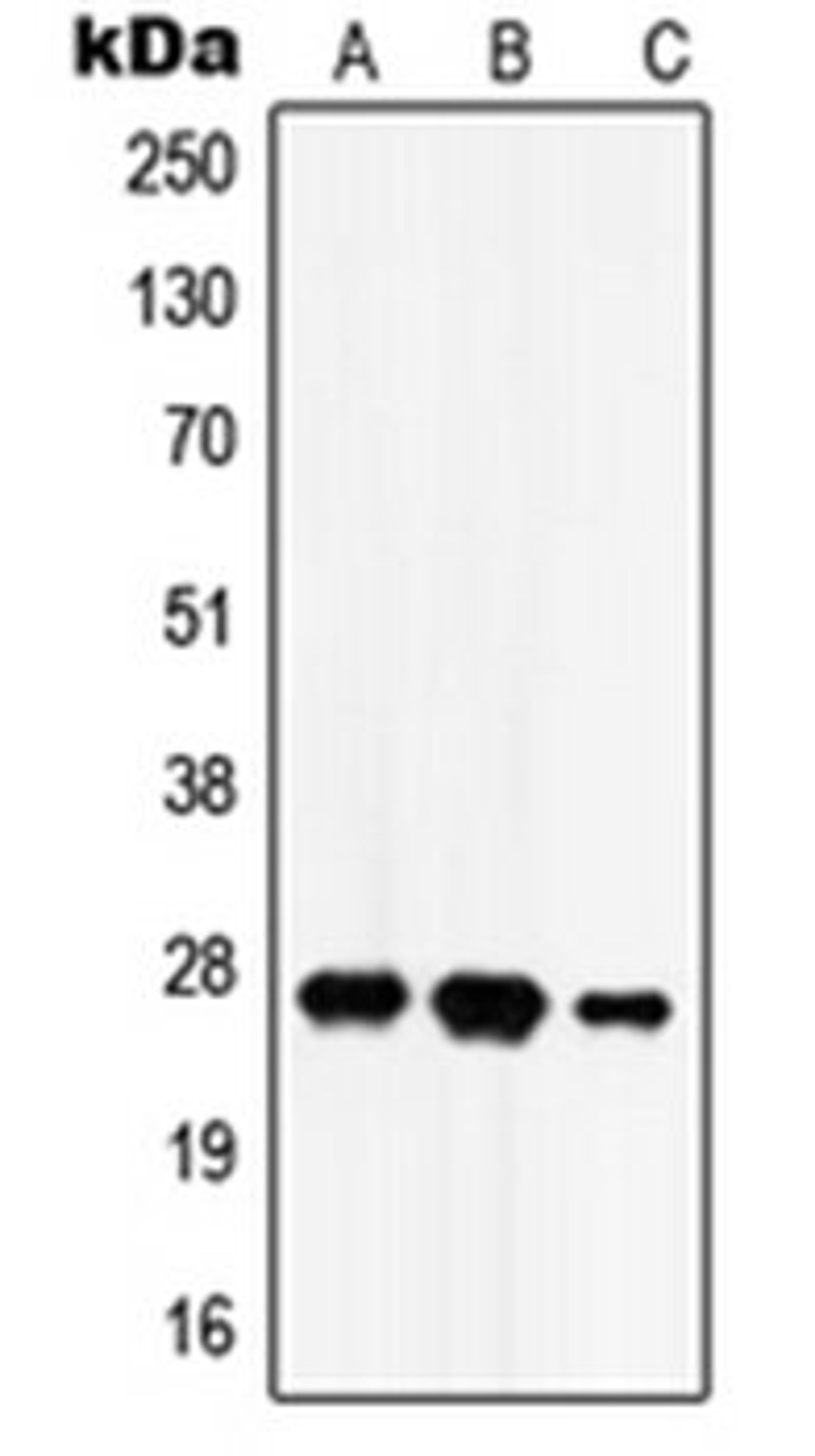 Western blot analysis of SKNSH (Lane 1), HEK293T (Lane 2), rat brain (Lane 3) whole cell lysates using HSD17B10 antibody