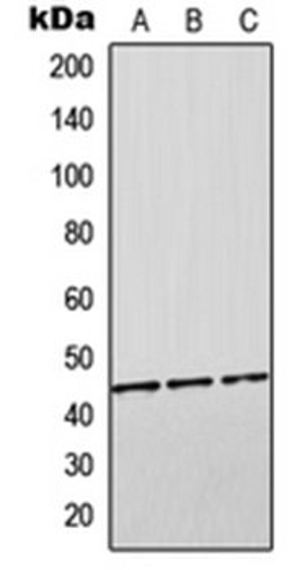 Western blot analysis of HEK293T (Lane 1), SP2/0 (Lane 2), H9C2 (Lane 3) whole cell lysates using ORM2 antibody