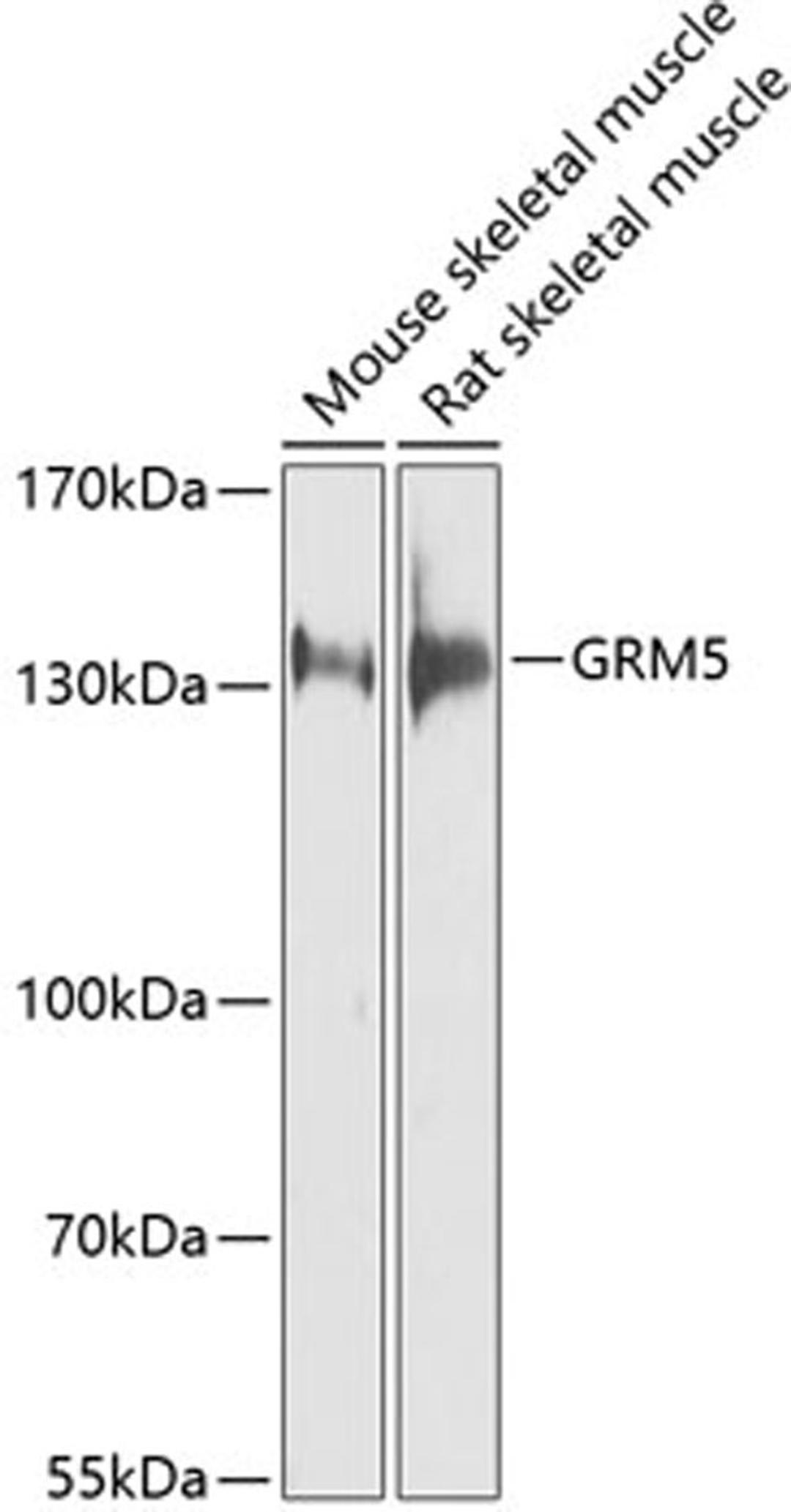 Western blot - GRM5 antibody (A9819)