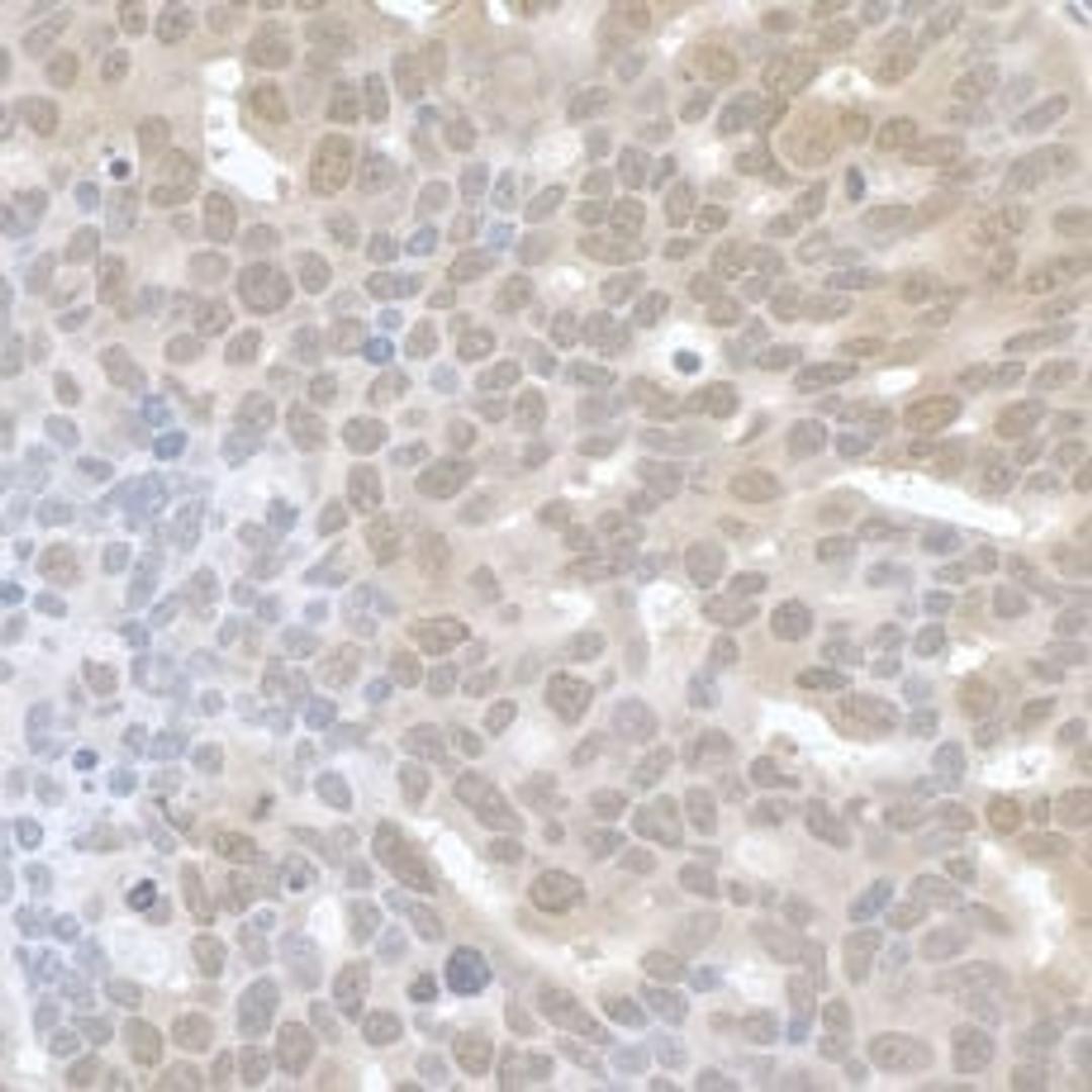 Detection of human UTX by immunohistochemistry.