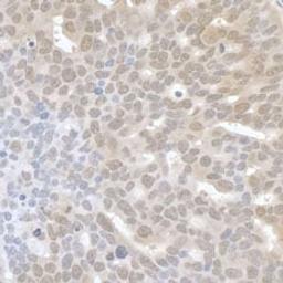 Detection of human UTX by immunohistochemistry.