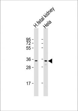 Western Blot at 1:2000 dilution Lane 1: human fetal kidney lysate Lane 2: Hela whole cell lysate Lysates/proteins at 20 ug per lane.