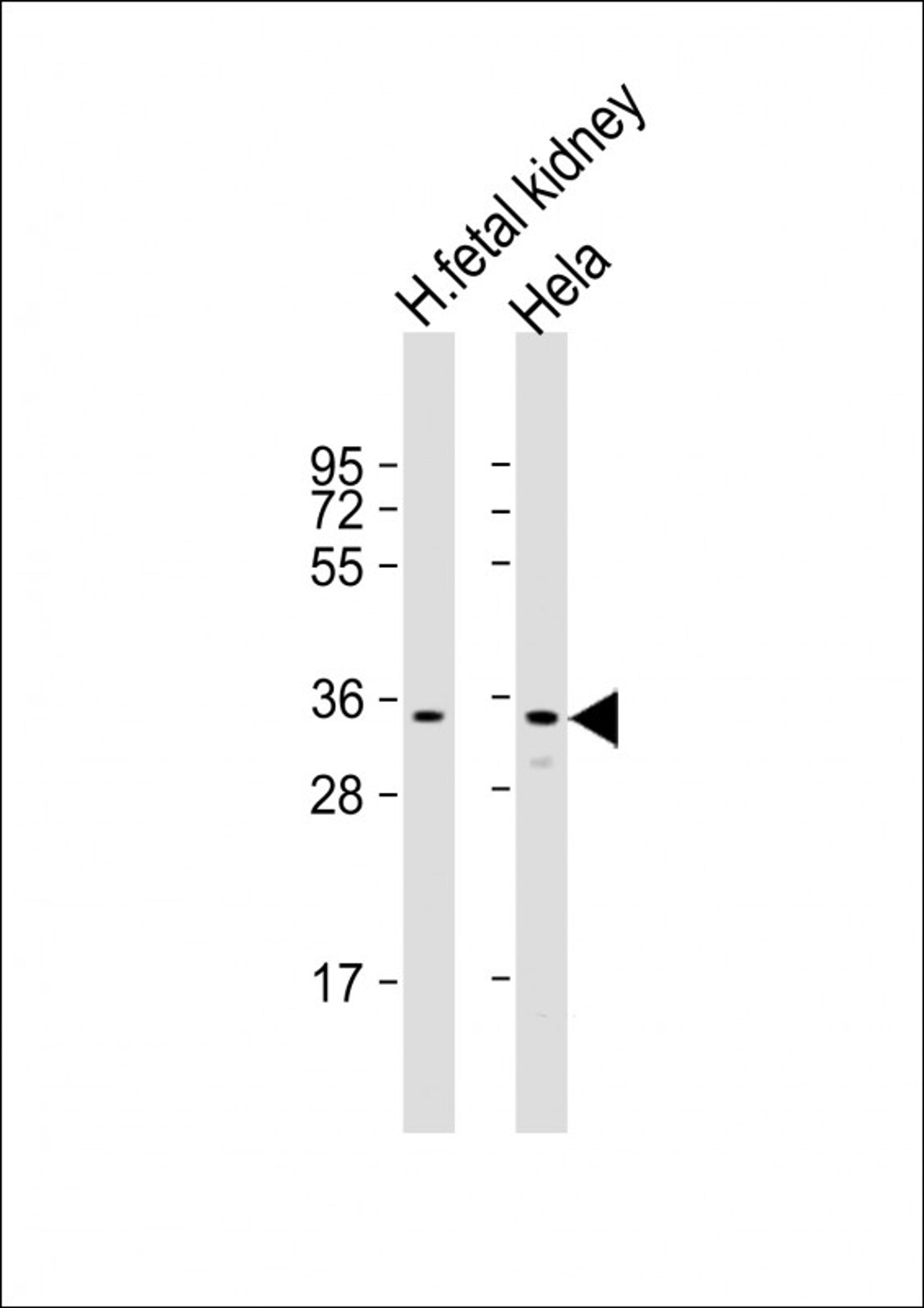 Western Blot at 1:2000 dilution Lane 1: human fetal kidney lysate Lane 2: Hela whole cell lysate Lysates/proteins at 20 ug per lane.