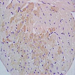 Immunohistochemical analysis of formalin-fixed and paraffin embedded mouse heart tissue (dilution at:1:200) using Cyp2-j3 antibody