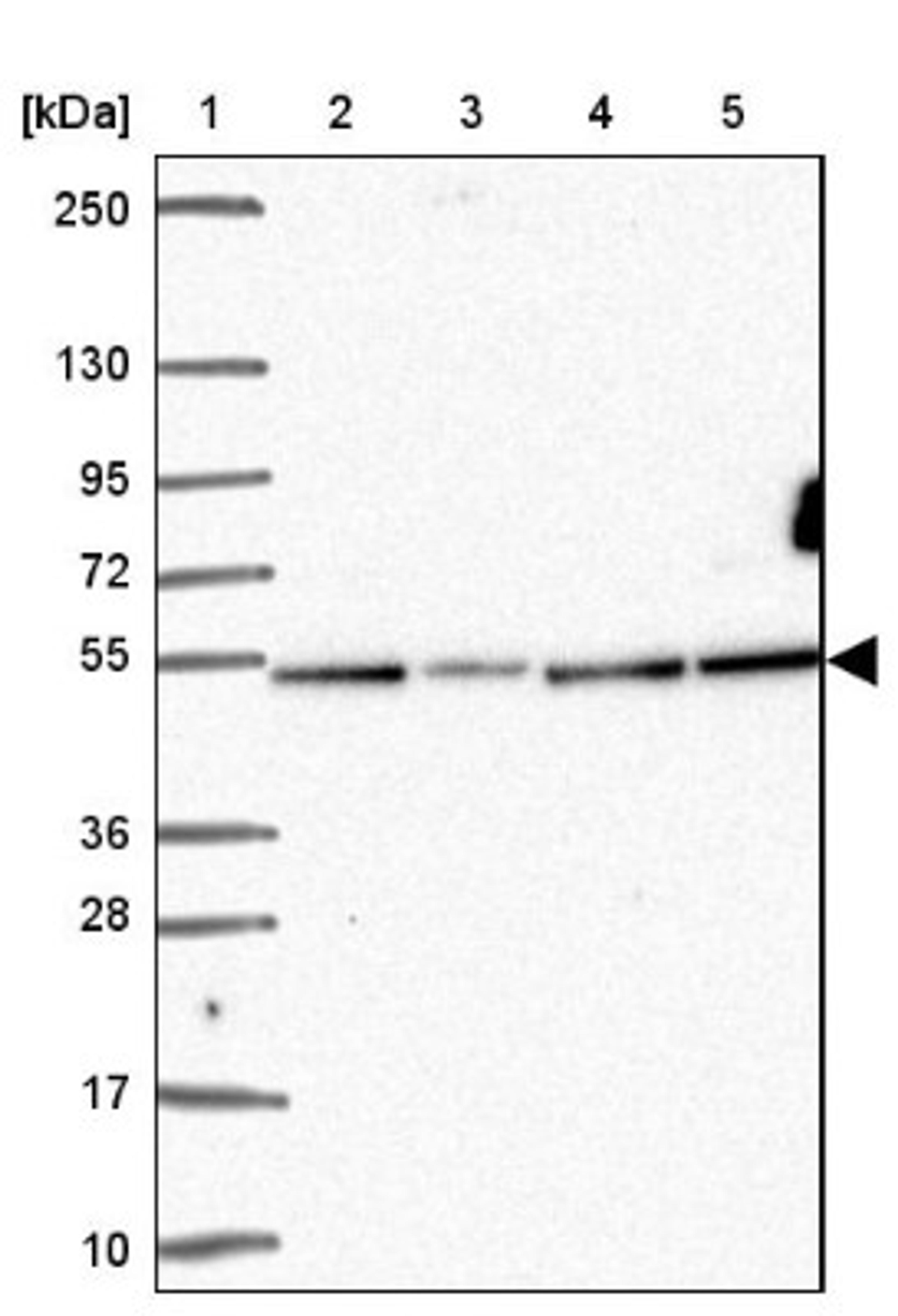 Western Blot: ZNF692 Antibody [NBP2-37973] - Lane 1: Marker [kDa] 250, 130, 95, 72, 55, 36, 28, 17, 10<br/>Lane 2: RT-4<br/>Lane 3: U-251 MG<br/>Lane 4: Human Plasma<br/>Lane 5: Liver