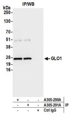 Detection of human GLO1/Glyoxalase I by western blot of immunoprecipitates.