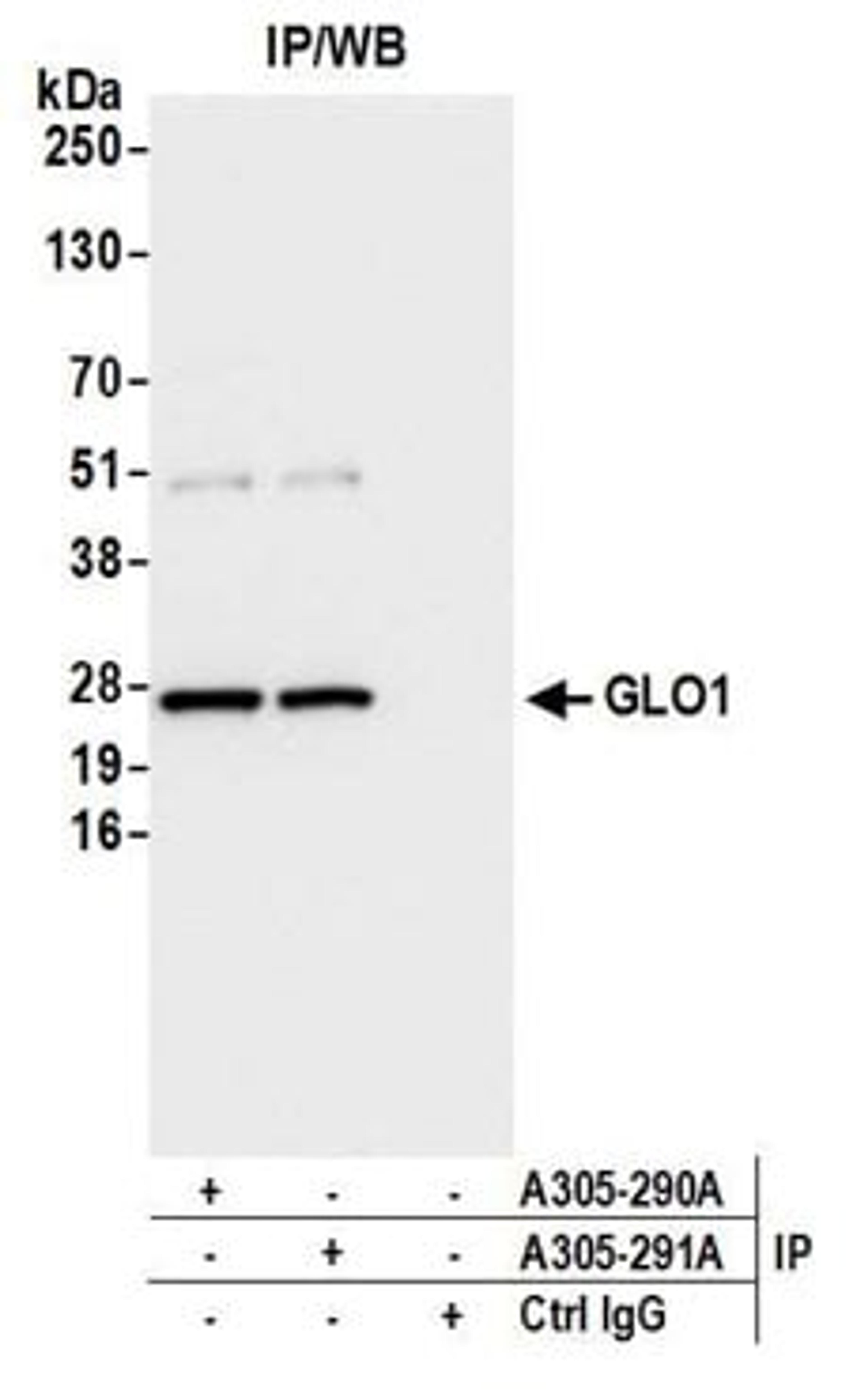 Detection of human GLO1/Glyoxalase I by western blot of immunoprecipitates.