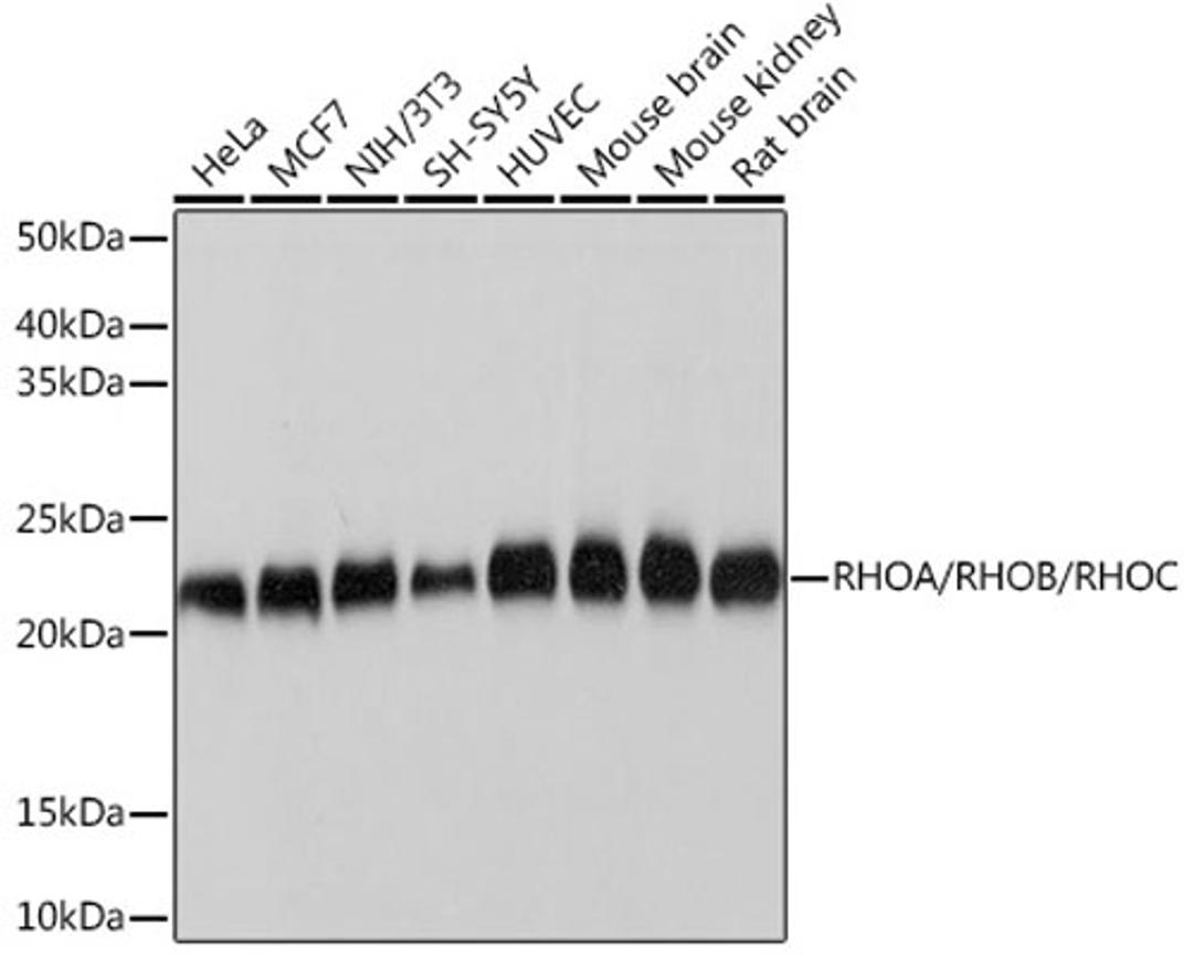 Western blot - RHOA/RHOB/RHOC Rabbit mAb (A4855)