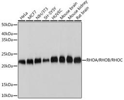 Western blot - RHOA/RHOB/RHOC Rabbit mAb (A4855)