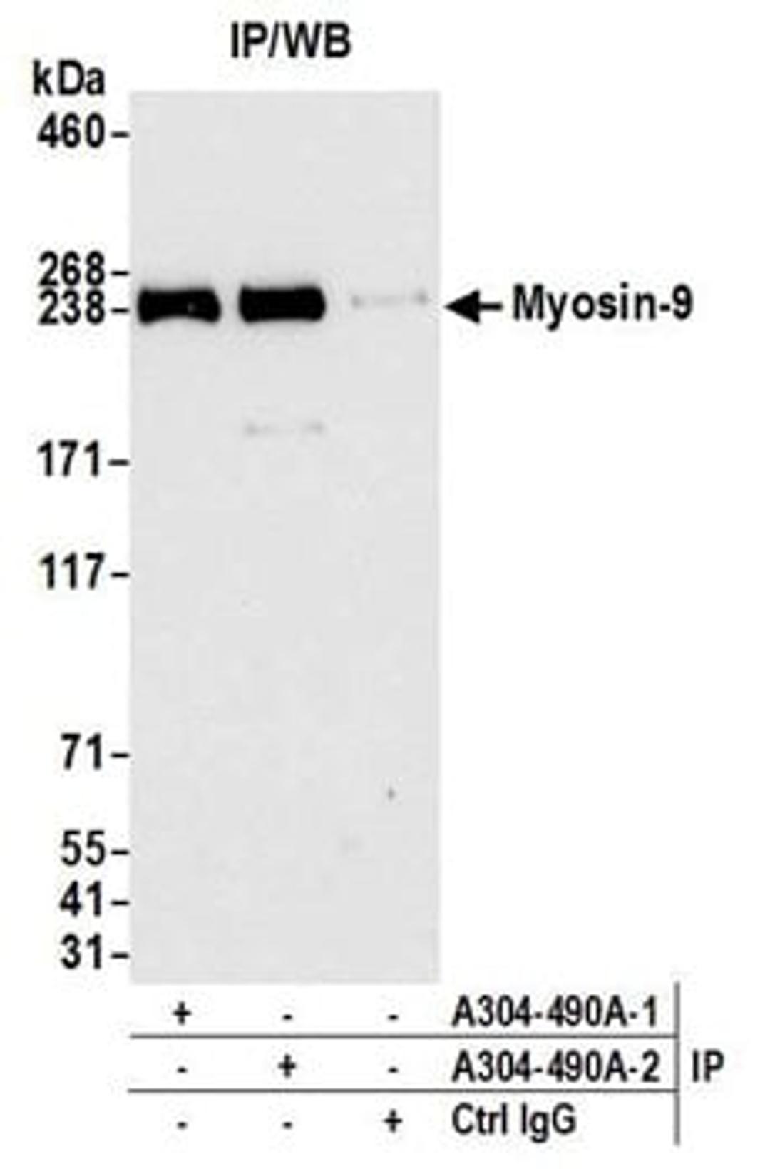 Detection of human Myosin-9 by western blot of immunoprecipitates.