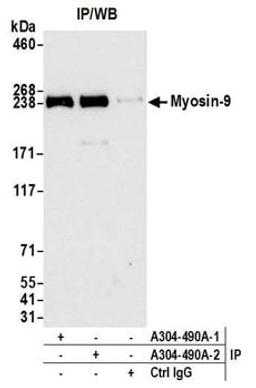 Detection of human Myosin-9 by western blot of immunoprecipitates.