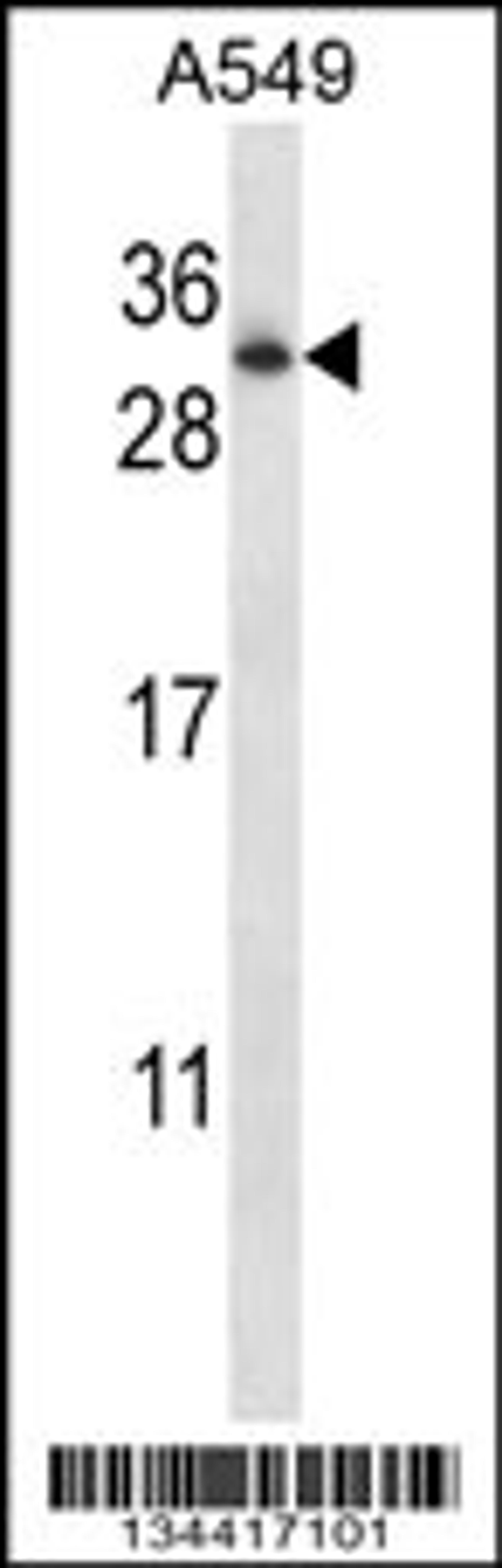 Western blot analysis in A549 cell line lysates (35ug/lane).