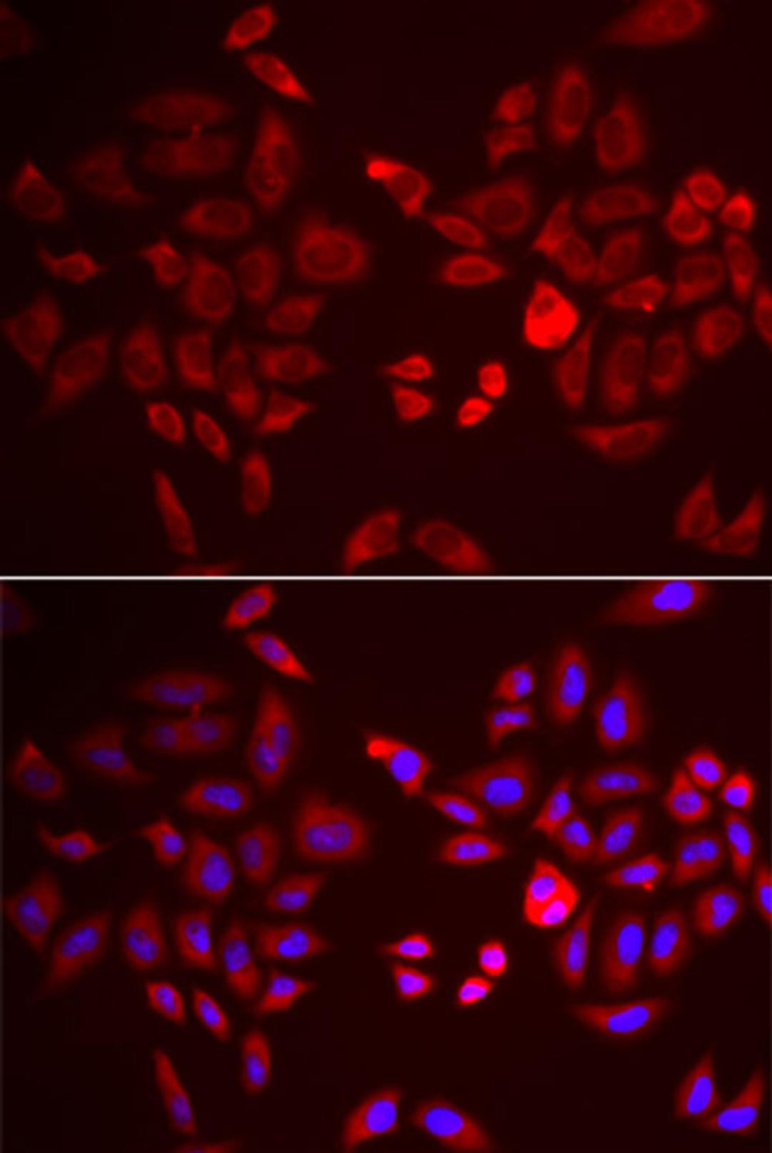 Immunofluorescence - PDK4 antibody (A3069)